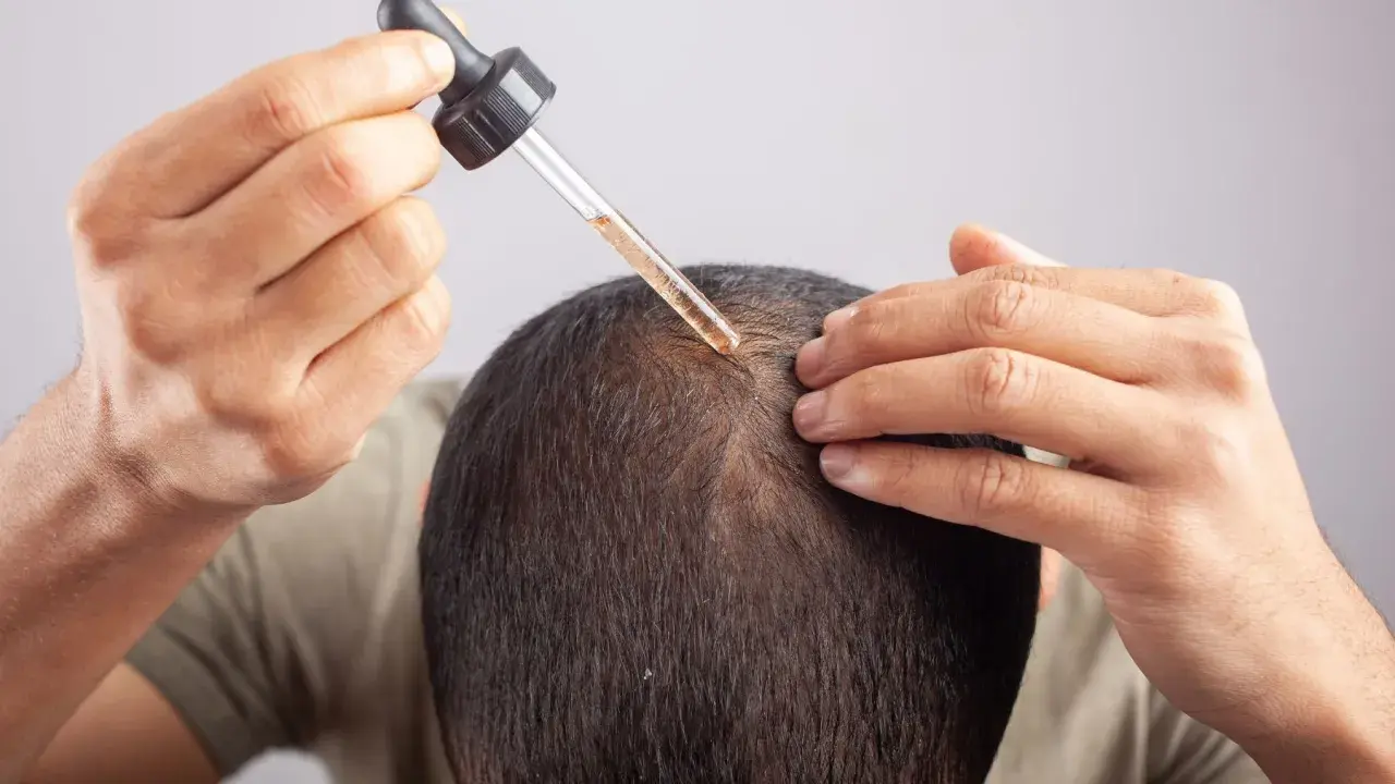Mężczyzna aplikuje serum na skórę głowy, by zwalczyć nadmierne wydzielanie sebum.