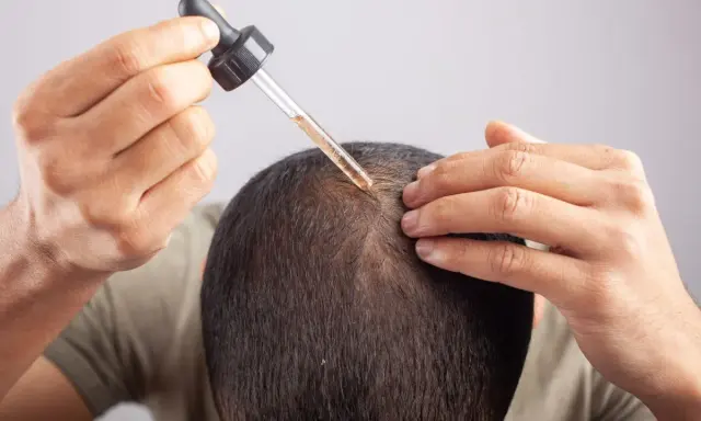 Mężczyzna aplikuje serum na skórę głowy, by zwalczyć nadmierne wydzielanie sebum.