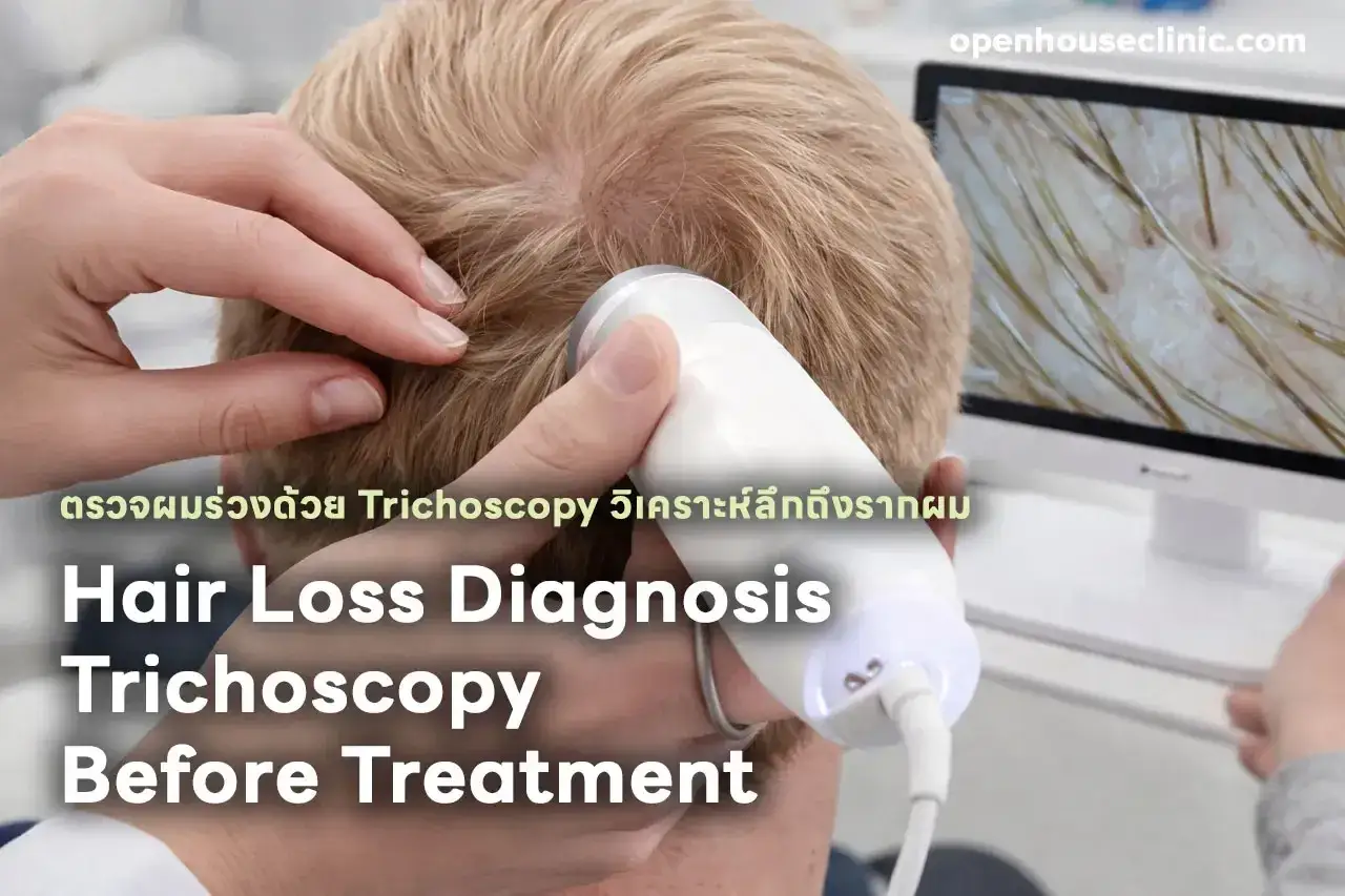 Diagnostyka utraty włos&oacute;w za pomocą trichoskopii. Specjalista bada sk&oacute;rę głowy, by ocenić przyczynę wypadania włos&oacute;w.